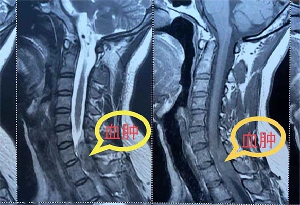 工作臺(tái)人體工程學(xué)的重要性